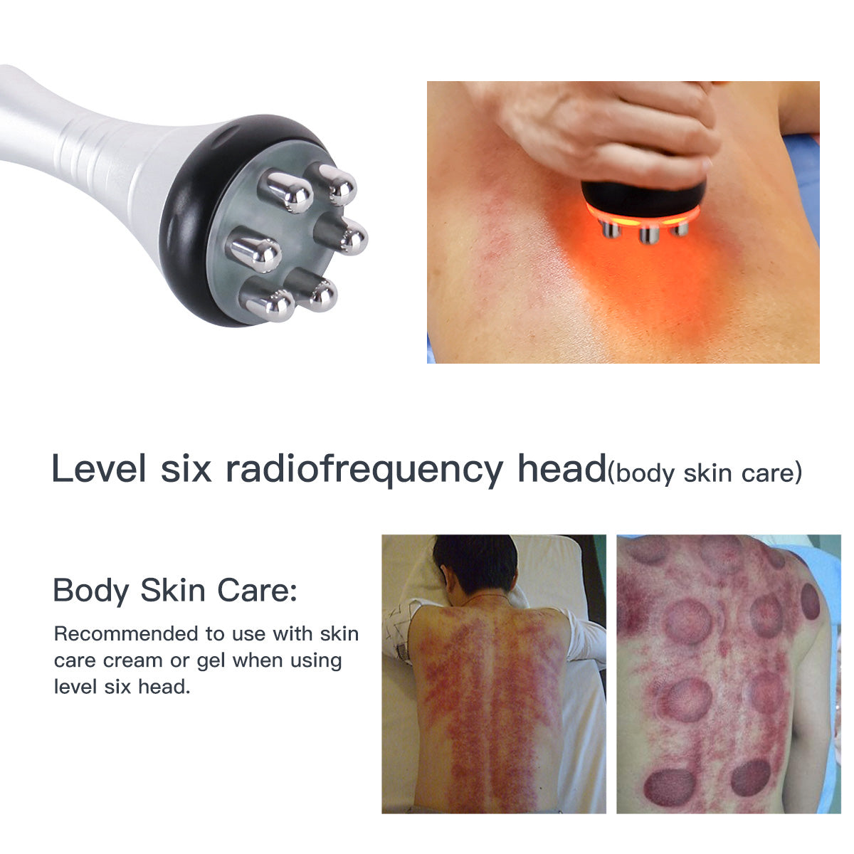 SQ47B Pro – 6-i-1 40K kavitasjonsapparat med RF, vakuum og EMS-laser