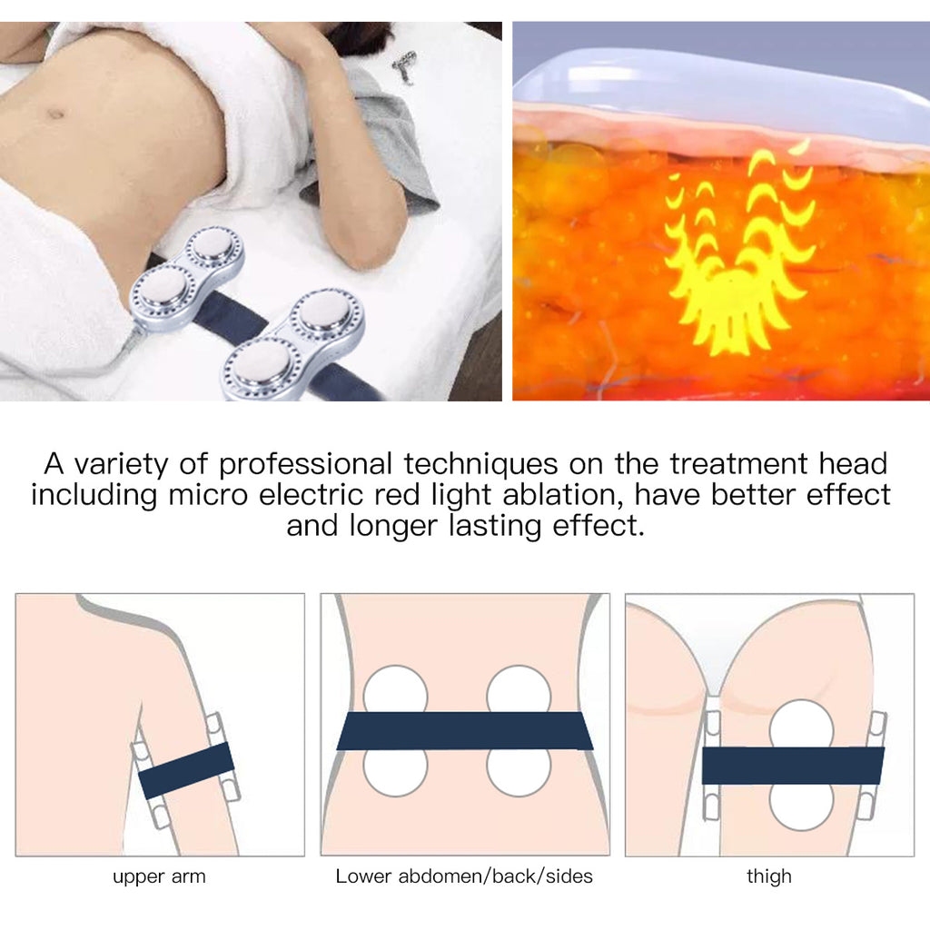 SQ47B Pro – 6-i-1 40K kavitasjonsapparat med RF, vakuum og EMS-laser