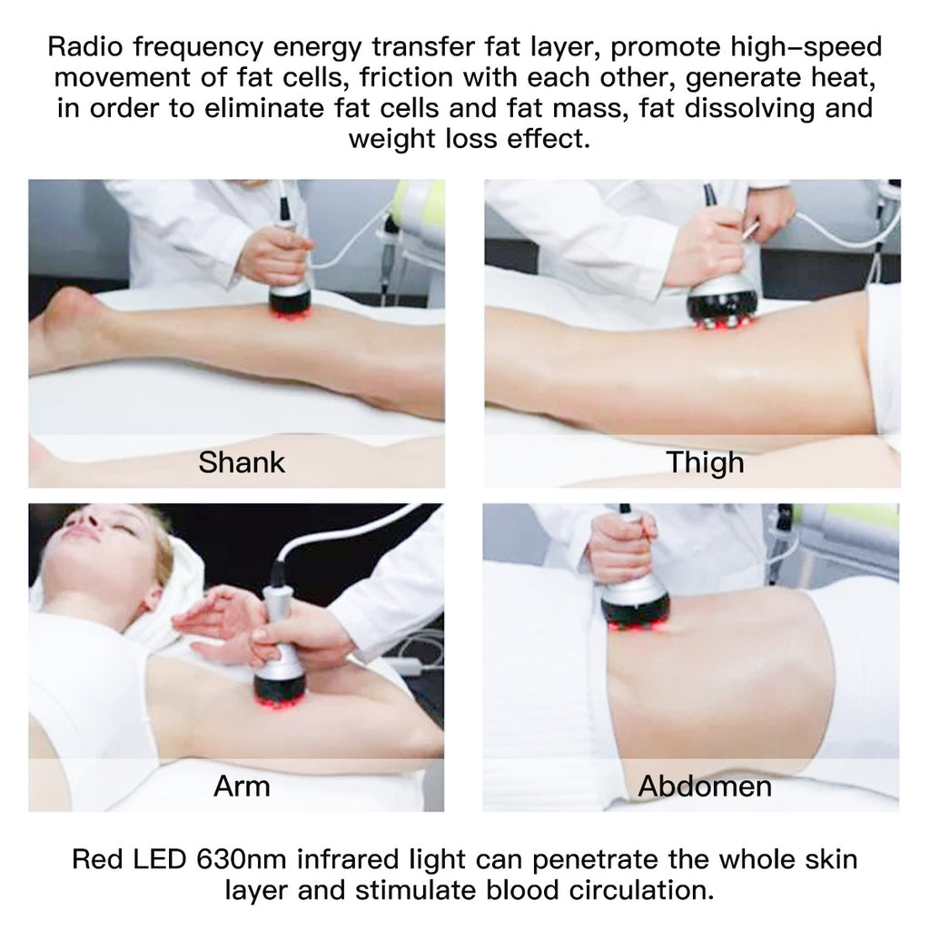 SQ47B Pro – 6-i-1 40K kavitasjonsapparat med RF, vakuum og EMS-laser