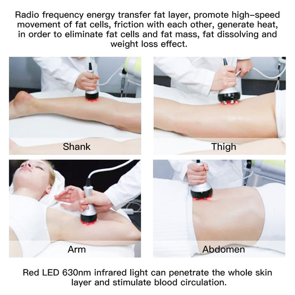 SQ47B Pro – 6-i-1 40K kavitasjonsapparat med RF, vakuum og EMS-laser