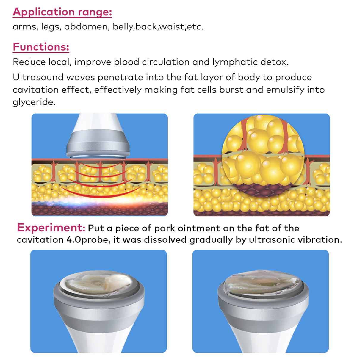 SQ169 Basic – 3-i-1 40K kavitasjonsapparat med 3-polet og 6-polet RF